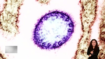 Brasil contra Fake: ministério esclarece que não há caso do vírus Nipah confirmado no país